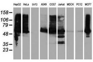 Image no. 14 for anti-IlvB (Bacterial Acetolactate Synthase)-Like (ILVBL) antibody (ABIN1498878) (ILVBL anticorps)