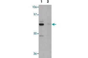 Western blot analysis of rat brain tissue with PIAS4 polyclonal antibody  at 1 ug/mL in (Lane 1) the absence and (Lane 2) the presence of blocking peptide . (PIAS4 anticorps  (N-Term))