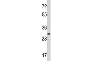 Western blot analysis of MARCKS antibody and HeLa lysate.