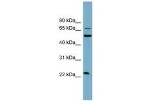 Image no. 1 for anti-C-Type Lectin Domain Family 6, Member A (CLEC6A) (AA 35-84) antibody (ABIN6743312) (C-Type Lectin Domain Family 6, Member A (CLEC6A) (AA 35-84) anticorps)