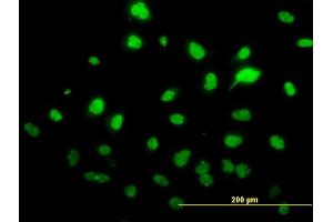 Immunofluorescence of monoclonal antibody to SAE1 on HeLa cell.