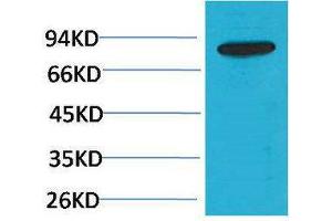Western Blotting (WB) image for anti-Phosphoinositide 3 Kinase, p85 beta (PI3K p85b) antibody (ABIN3181564) (PIK3R2 anticorps)