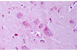 Anti-GABRB1 antibody IHC staining of human brain, cortex neurons. (GABRA1 anticorps  (AA 327-450))