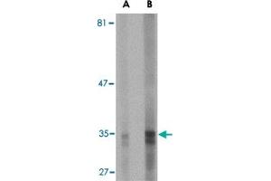 Western blot analysis of ENDOG expression in HepG2 cell lysate with ENDOG monoclonal antibody, clone 7G1G10  at (A) 5 and (B) 10 ug/mL . (Endonuclease G anticorps  (AA 76-170))