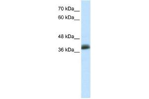 Human MCF-7; WB Suggested Anti-SAP30BP Antibody Titration: 0. (SAP30BP anticorps  (C-Term))