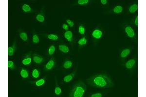 Immunofluorescence analysis of A549 cells using UBE2V1 antibody. (UBE2V1 anticorps  (AA 1-147))