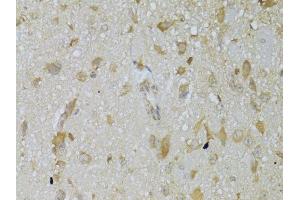 Immunohistochemistry of paraffin-embedded mouse brain using TSHR Antibody.