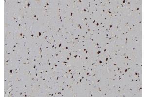 ABIN6264280 and ABIN6276989 at 1/100 staining Human heart tissue by IHC-P. (Phospholipase C beta 1 anticorps  (Internal Region))