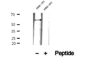 Western blot analysis of extracts of HEK-293 cells, using GEFT antibody. (ARHGEF25/GEFT anticorps  (Internal Region))
