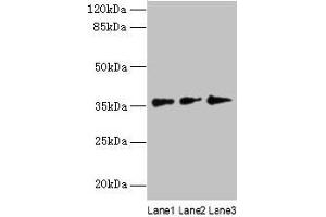 Western blot All lanes: LDAH antibody at 8 μg/mL Lane 1: Hela whole cell lysate Lane 2: Jurkat whole cell lysate Lane 3: A431 whole cell lysate Secondary Goat polyclonal to rabbit IgG at 1/10000 dilution Predicted band size: 38, 33, 23 kDa Observed band size: 38 kDa (LDAH/C2orf43 anticorps  (AA 1-325))