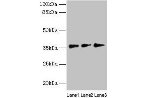 LDAH/C2orf43 抗体  (AA 1-325)