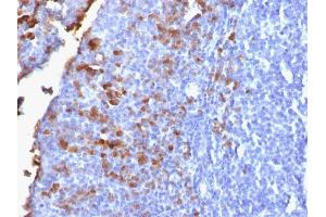 Formalin-fixed, paraffin-embedded human Tonsil stained with IgG Rabbit Recombinant Monoclonal Antibody (IG1707R). (Recombinant IGHG anticorps)