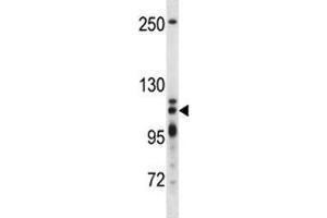 XRN2 antibody western blot analysis in T47D lysate (XRN2 anticorps  (AA 48-76))