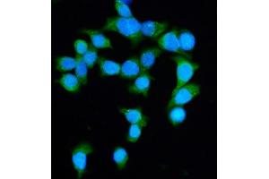 IF analysis of DIAPH1 using anti-DIAPH1 antibody (ABIN7599652). (DIAPH1 anticorps  (AA 1039-1153))