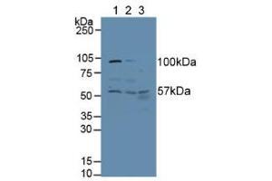 Western blot analysis of (1) Human HeLa cells, (2) Human A431 Cells and (3) Human Liver Tissue. (ALT anticorps  (AA 255-496))