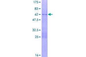Image no. 1 for Telomeric Repeat Binding Factor 2 (TERF2) (AA 1-251) protein (GST tag) (ABIN1322480)