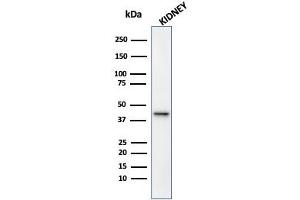 Western Blot Analysis of Human Kidney tissue lysate using AMACR / p504S Rabbit Monoclonal Antibody (13H4).
