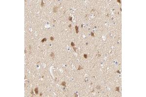 Immunohistochemical staining of human cerebral cortex with SULT4A1 polyclonal antibody  shows moderate cytoplasmic positivity in neuronal cells. (SULT4A1 anticorps)