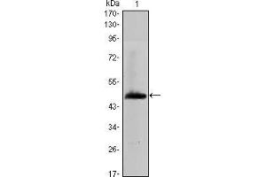 Western blot analysis using HAS1 mAb against human HAS1 (AA: 74-243) recombinant protein.
