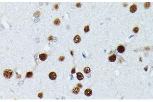 Immunohistochemistry of paraffin-embedded Rat brain using MEF2C Polyclonal Antibody at dilution of 1:100 (40x lens).