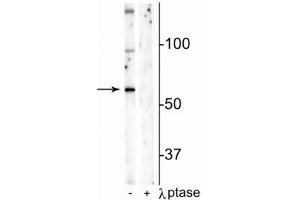 Western blot of mouse hippocampal lysate showing specific immunolabeling of the ~65 kDa Munc18-1 protein phosphorylated at Ser241 in the first lane (-). (STXBP1 anticorps  (pSer241))