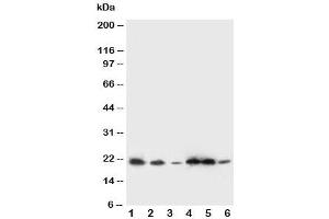Western blot testing of SSR3 antibody and Lane 1:  rat liver (SSR3 anticorps  (AA 8-23))