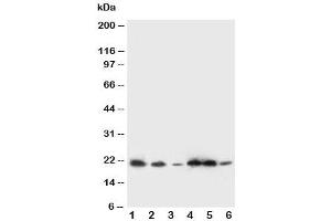Western blot testing of SSR3 antibody and Lane 1:  rat liver