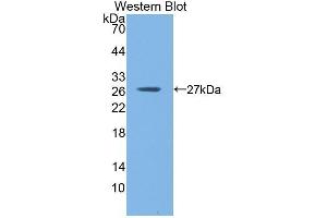 Western Blotting (WB) image for anti-Glutathione S-Transferase mu 1 (GSTM1) (AA 1-218) antibody (ABIN1078083) (GSTM1 anticorps  (AA 1-218))