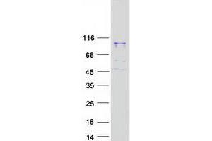 Validation with Western Blot