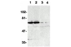 Western Blotting (WB) image for anti-Tumor Necrosis Factor Receptor Superfamily, Member 21 (TNFRSF21) antibody (ABIN1031729) (TNFRSF21 anticorps)