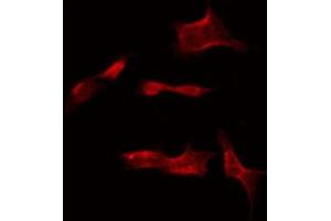 ABIN6275308 staining COLO205 by IF/ICC. (NSG1 anticorps  (Internal Region))