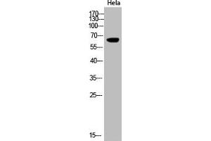 Western Blot analysis of Hela cells using Acetyl-Cytokeratin-pan (K194) Polyclonal Antibody (KRT2/KRT76/KRT3/KRT5/KRT6A/KRT6B/KRT6C/KRT71/KRT72/KRT73/KRT74/KRT75/KRT79/KRT7/KRT8/KRT84 (acLys194) anticorps)