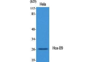 Western Blotting (WB) image for anti-Homeobox B9 (HOXB9) (C-Term) antibody (ABIN3185075)