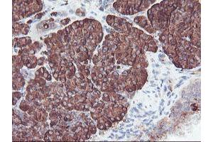 Image no. 4 for anti-Carboxypeptidase A2 (Pancreatic) (CPA2) antibody (ABIN1497596)