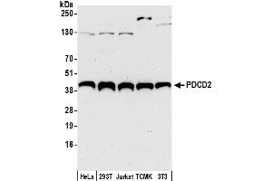 anti-Programmed Cell Death 2 (PDCD2) (AA 294-344) antibody