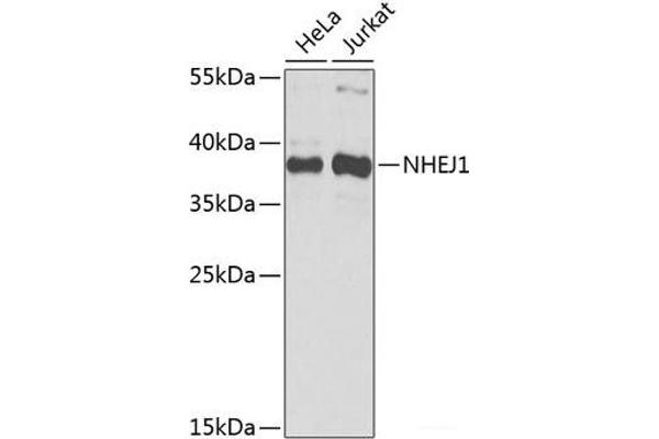 NHEJ1 anticorps