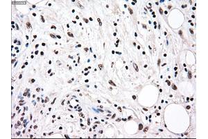 Immunohistochemical staining of paraffin-embedded colon tissue using anti-RAD9Amouse monoclonal antibody. (RAD9A anticorps)
