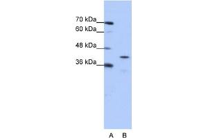 WB Suggested Anti-CPEB2 Antibody Titration:  0.