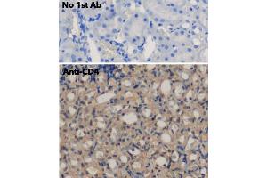 IHC of mouse kidney carcinoma using anti-CD4 antibody and FFPE tissue after heat-induced antigen retrieval.