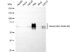 Western blotting analysis using transcription factor EB antibody (ABIN7800595).