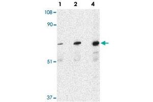 Western blot analysis of PAK6 in Raji lysate with PAK6 polyclonal antibody  at 1, 2, and 4 ug/mL .