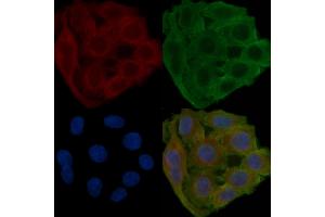 ABIN7094432 and ABIN7098480 staining Hela cells(24h of starvation treatment) by IF/ICC. (ALDH1L1 anticorps  (C-Term))