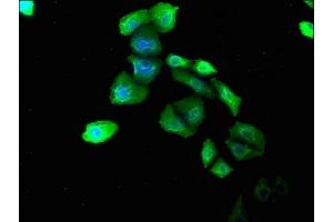 Immunofluorescence staining of Hela cells with ABIN7139783 at 1:180, counter-stained with DAPI. (COL6A1 anticorps  (AA 64-80))