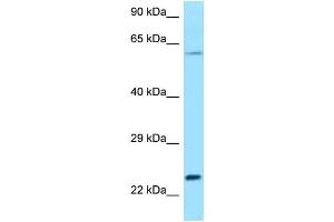 WB Suggested Anti-Rac2 Antibody Titration: 1.