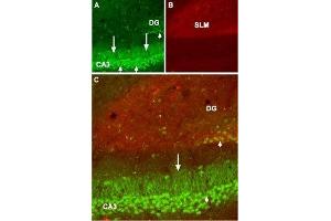 Expression of GABA(B) receptor 1 in mouse hippocampus - Immunohistochemical staining of mouse hippocampus frozen sections using Anti-GABA(B) R1 (extracellular) Antibody (ABIN7043195, ABIN7044319 and ABIN7044320), (1:100).