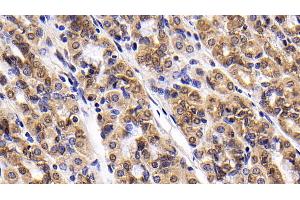 Detection of Surv in Human Stomach Tissue using Monoclonal Antibody to Survivin (Surv) (Survivin anticorps  (AA 1-142))