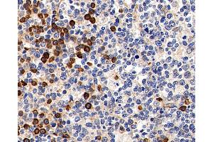 Immunohistochemistry analysis of paraffin-embedded Human tonsil using Cyclin B1 Polyclonal Antibody at dilution of 1:300. (Cyclin B1 anticorps)