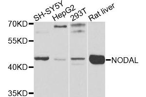 Western blot analysis of extracts of various cells, using NODAL antibody. (Nodal anticorps)