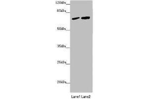 Western blot All lanes: KIAA0391 antibody at 1. (KIAA0391 anticorps  (Catalytic Subunit))