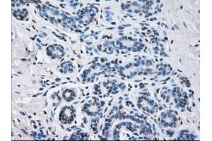 Immunohistochemical staining of paraffin-embedded breast tissue using anti-SORD mouse monoclonal antibody. (SORD anticorps)